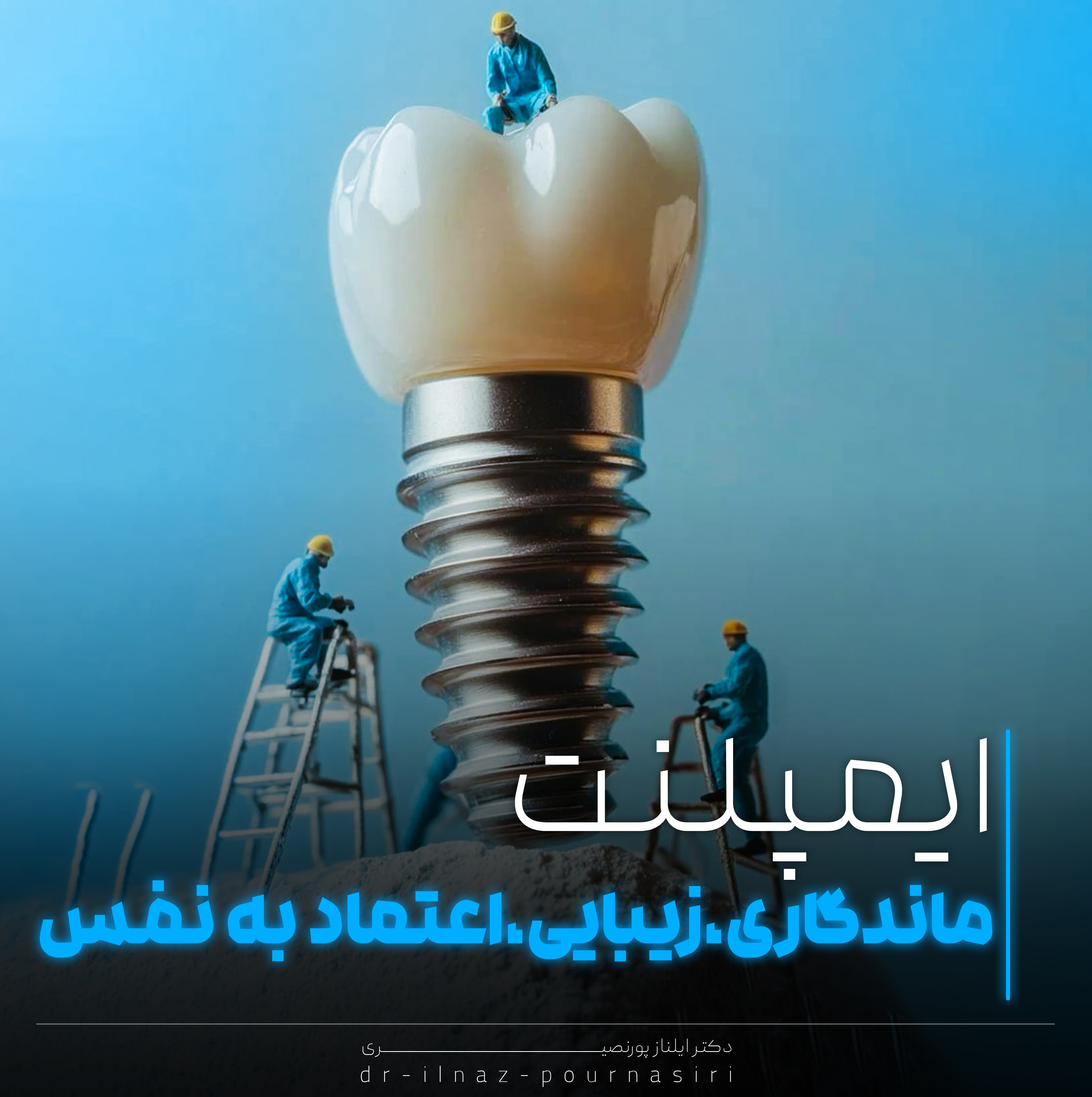 ایمپلنت